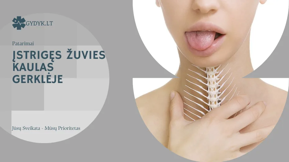 Įstrigęs žuvies kaulas gerklėje