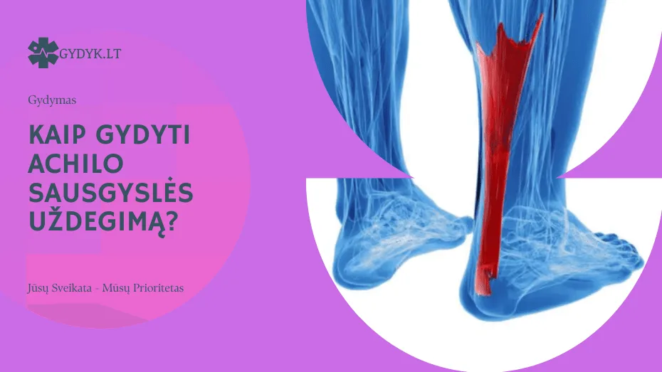 Kaip gydyti Achilo sausgyslės uždegimą?