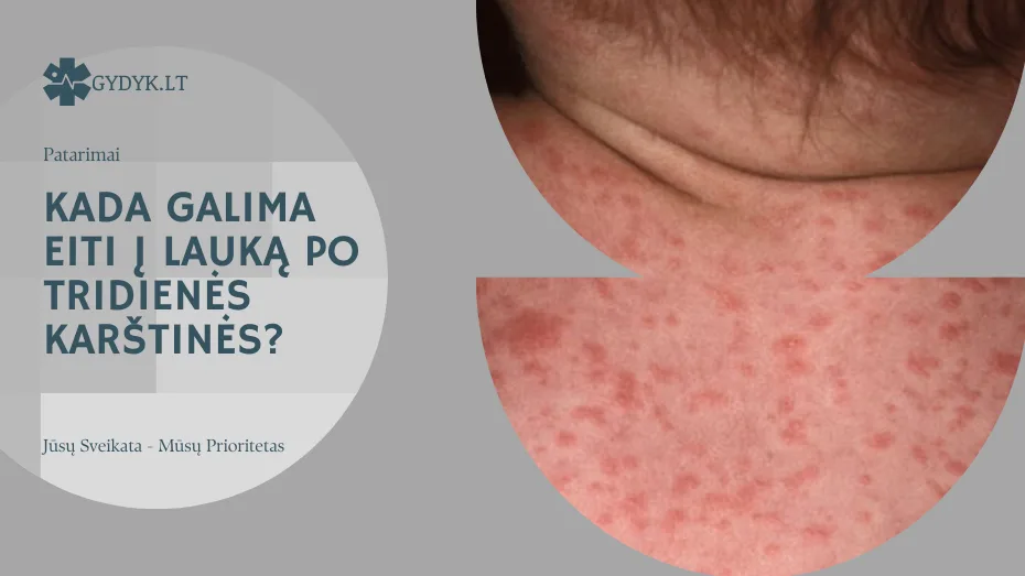 Kada galima eiti į lauką po tridienės karštinės