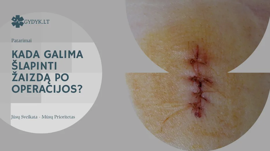 Kada galima šlapinti žaizdą po operacijos? Kada galima šlapinti žaizdą po operacijos