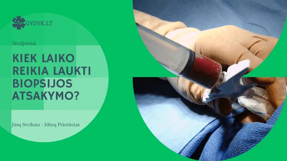 Kiek laiko reikia laukti biopsijos atsakymo? Kiek laiko reikia laukti biopsijos atsakymo