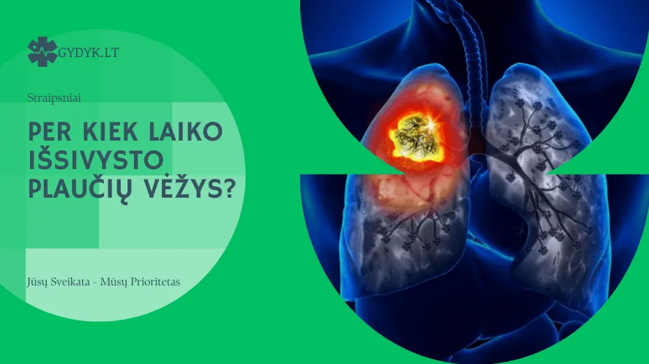 Per kiek laiko išsivysto plaučių vėžys? Per kiek laiko išsivysto plaučių vėžys