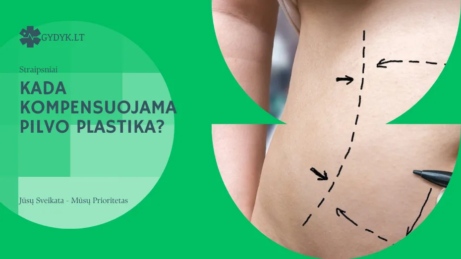 Kada kompensuojama pilvo plastika
