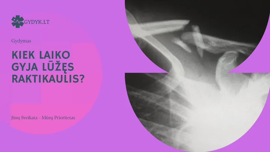 Kiek laiko gyja lūžęs raktikaulis