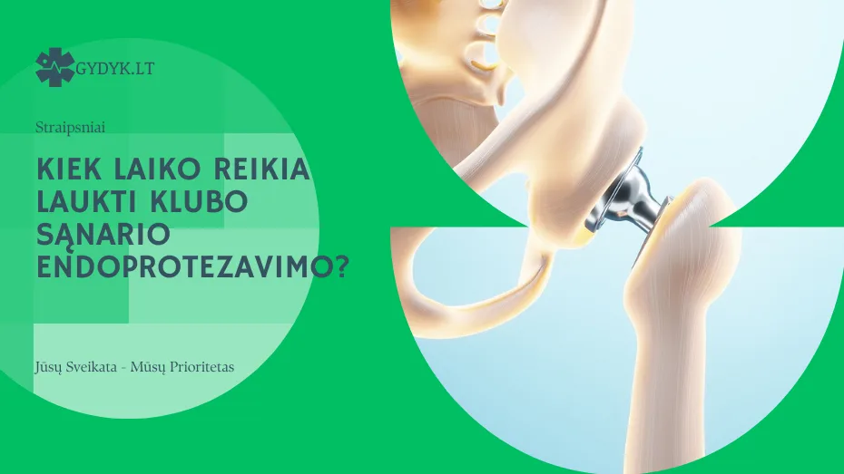 Kiek laiko reikia laukti klubo sąnario endoprotezavimo? Kiek laiko reikia laukti klubo sąnario endoprotezavimo