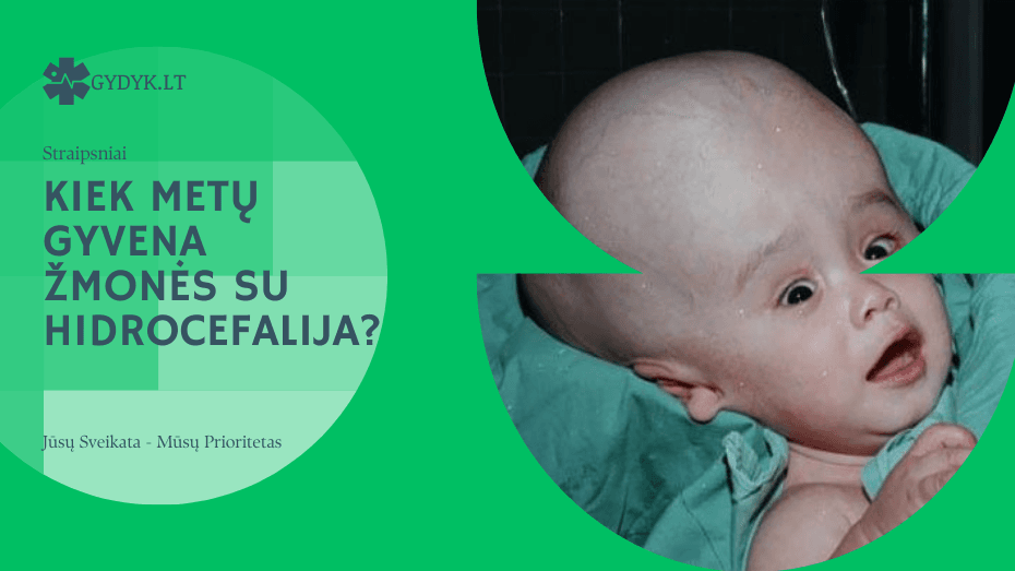 Kiek metų gyvena žmonės su hidrocefalija