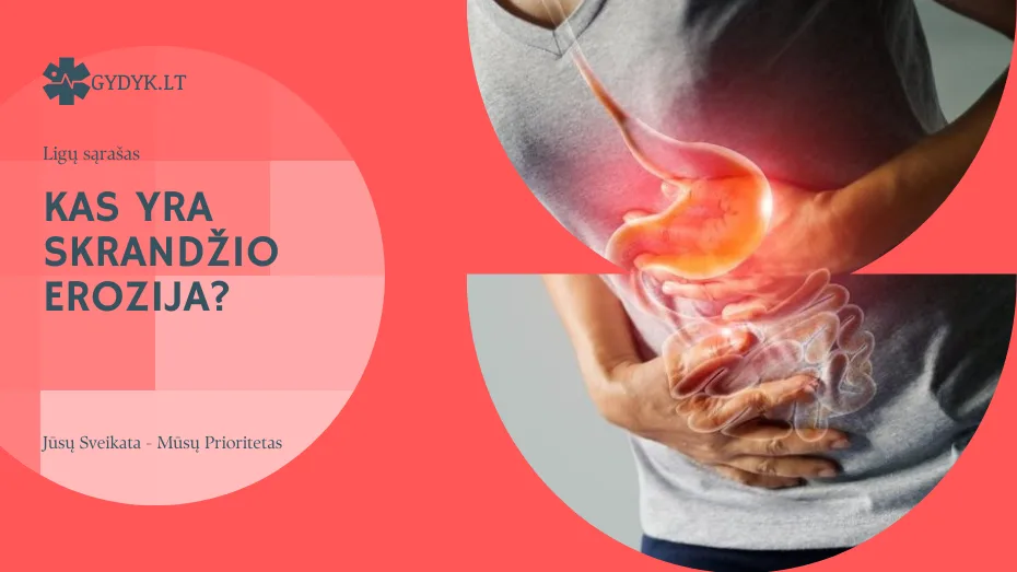 Skrandžio erozija: kas tai ir kaip ją gydyti? kas yra skrandžio erozija