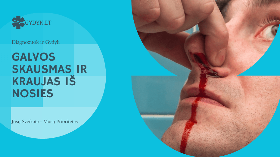 Galvos skausmas ir kraujas iš nosies: ką tai reiškia ir ką daryti? Galvos skausmas ir kraujas iš nosies
