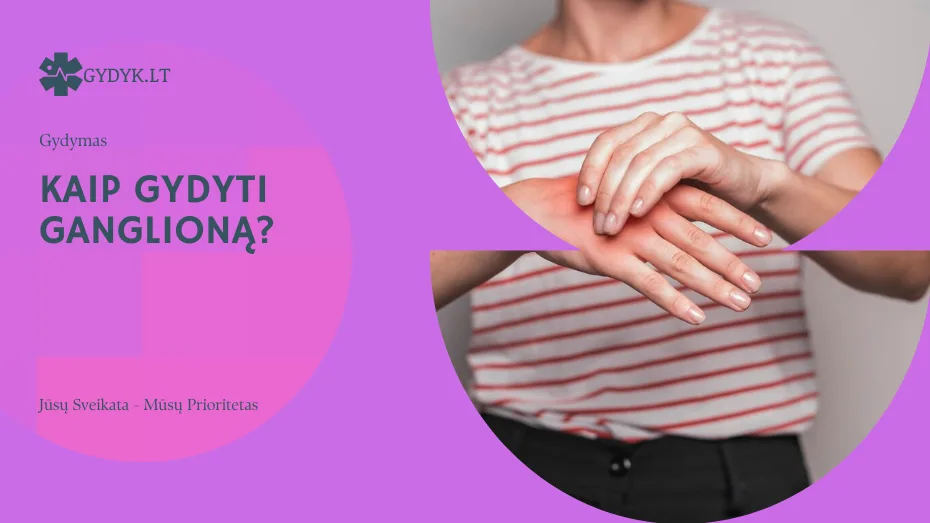 Kaip gydyti ganglioną