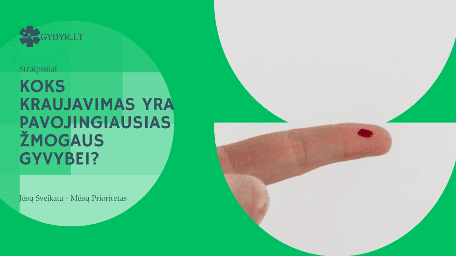 Koks kraujavimas yra pavojingiausias žmogaus gyvybei