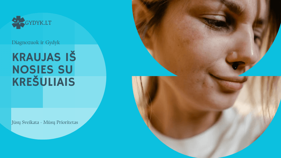 Kraujas iš nosies su krešuliais