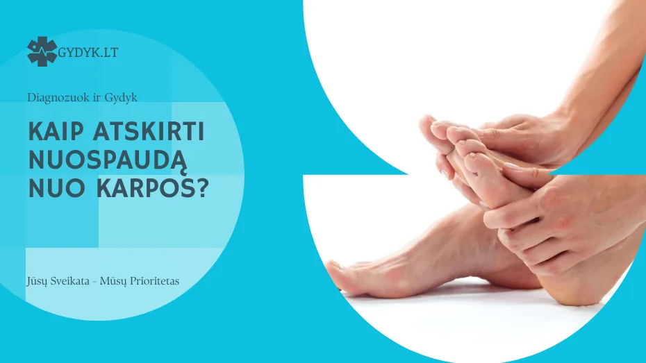 kaip atskirti nuospaudą nuo karpos