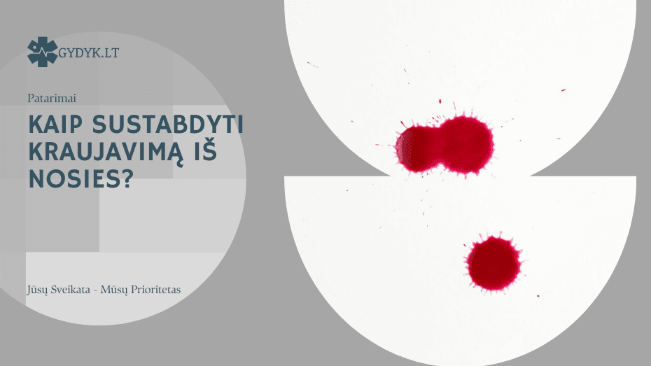 Gydytoja aiškina: kaip sustabdyti kraujavimą iš nosies kaip sustabdyti kraujavimą iš nosies