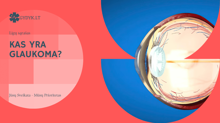 kas yra glaukoma
