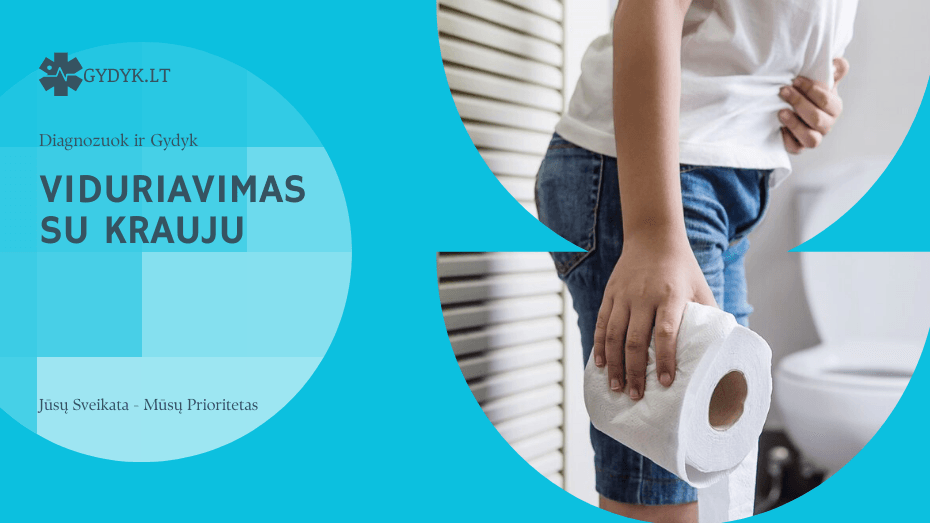 Išmatos su krauju: ką daryti? viduriavimas su krauju