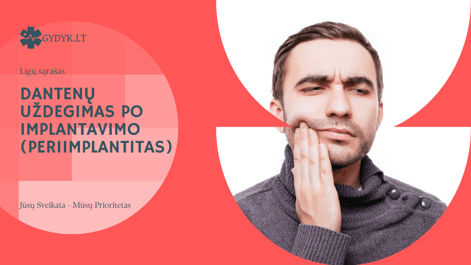 Tarpšonkaulinio nervo uždegimas: kokie simptomai ir koks reikalingas gydymas ar vaistai? Dantenų uždegimas po implantavimo (Periimplantitas)