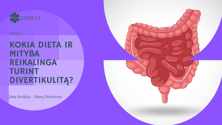 Kokia dieta ir mityba reikalinga turint divertikulitą? Kokia dieta ir mityba reikalinga turint divertikulitą