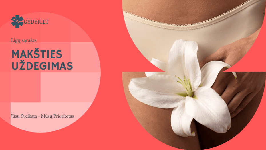 Makšties uždegimas – priežastys, simptomai ir kaip gydyti? Makšties uždegimas