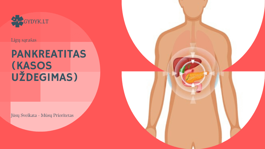 Pankreatitas (kasos uždegimas): požymiai, simptomai ir gydymas Pankreatitas (kasos uždegimas)