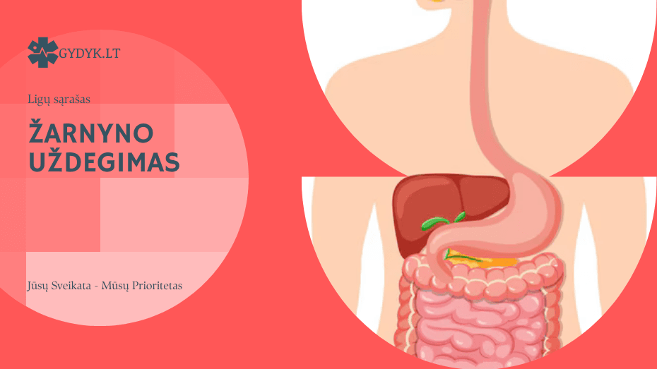 Žarnyno uždegimas – priežastys, simptomai ir kaip gydyti? Žarnyno uždegimas