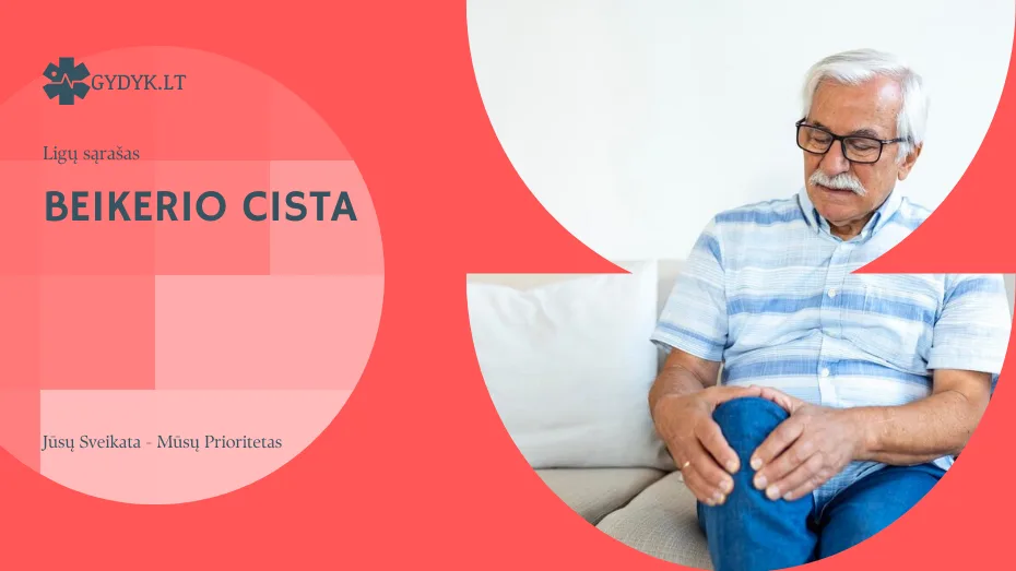 beikerio cista