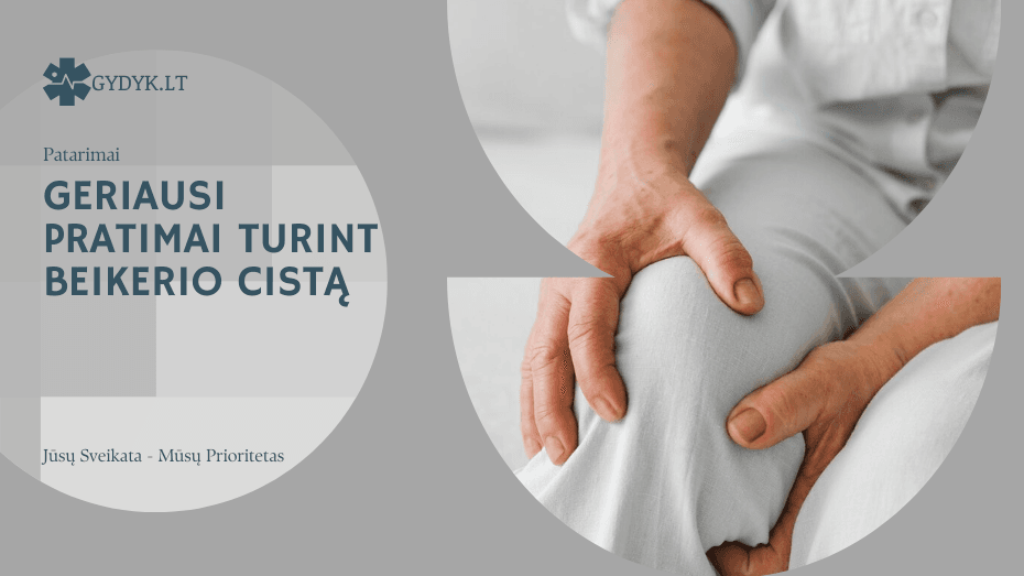 TOP 7 geriausi pratimai, turint Beikerio cistą: ką daryti, kad sumažintumėte diskomfortą? geriausi pratimai turint beikerio cistą