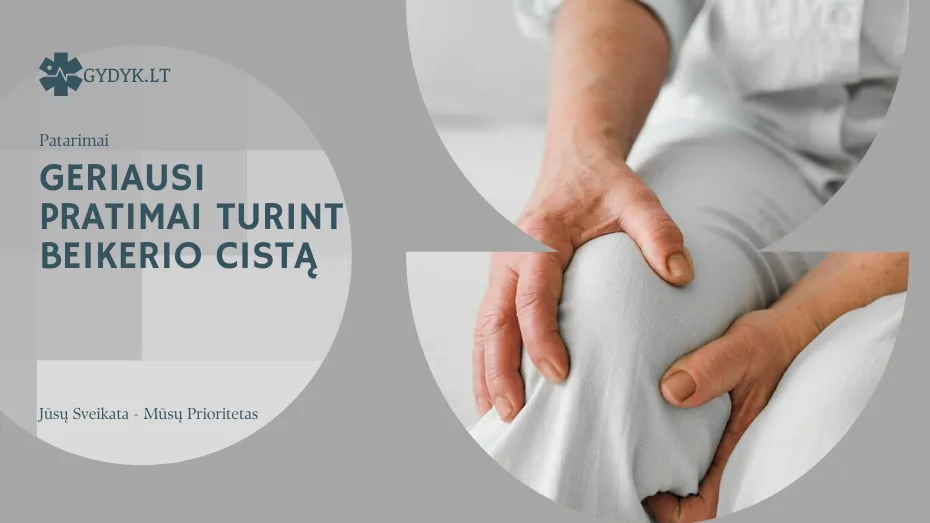 geriausi pratimai turint beikerio cistą