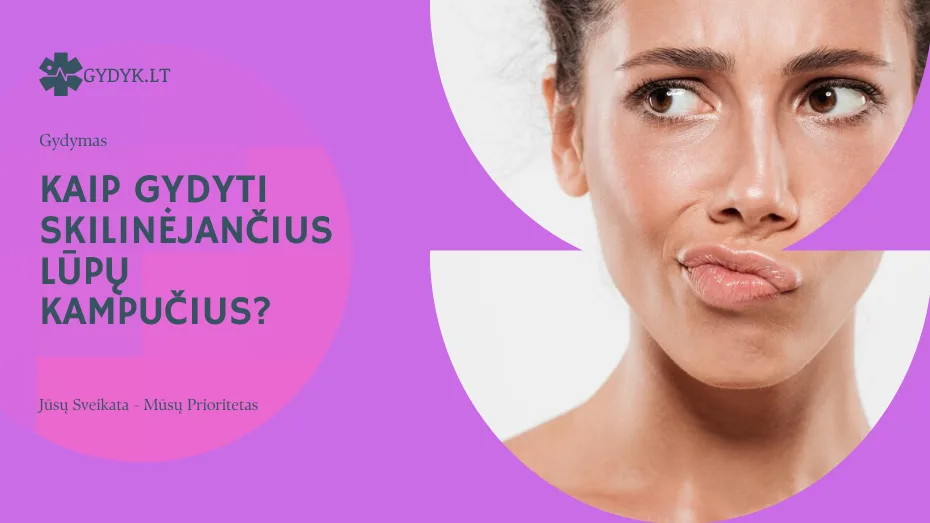 kaip gydyti skilinėjančius lūpų kampučius