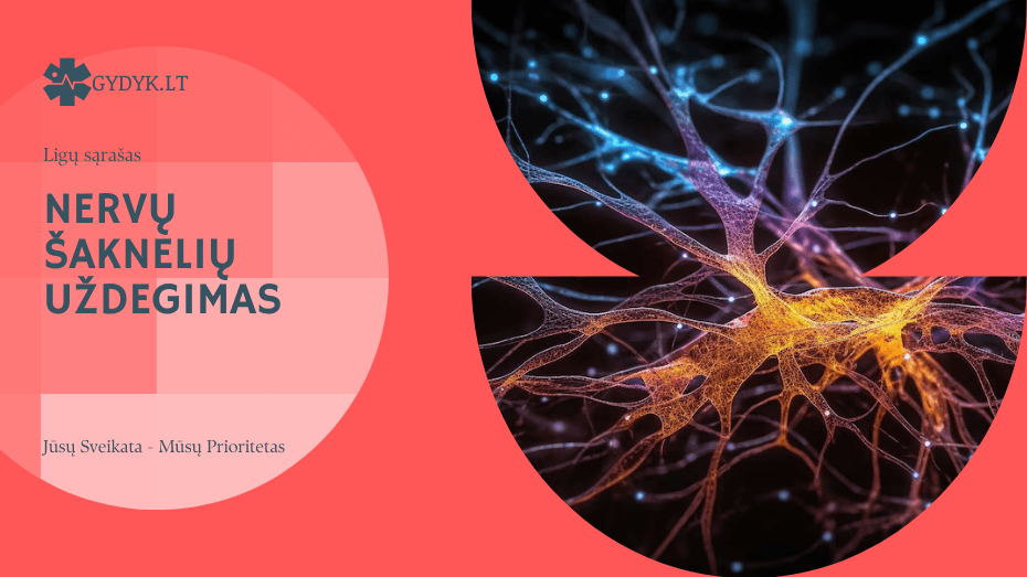 Kas yra nervų šaknelių uždegimas: priežastys, simptomai ir kaip gydyti? nervų šaknelių uždegimas