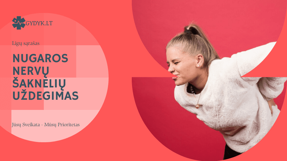 Kas yra nugaros nervų šaknelių uždegimas: kokie simptomai ir kaip gydyti? nugaros nervų šaknelių uždegimas