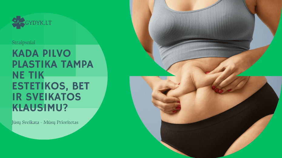 Riboksinas ar Mildronatas – ką naudoti geriau? Kada pilvo plastika tampa ne tik estetikos, bet ir sveikatos klausimu