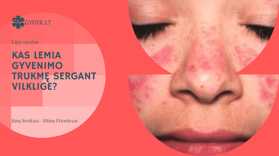 Kas lemia gyvenimo trukmę sergant vilklige? Kas lemia gyvenimo trukmę sergant vilklige