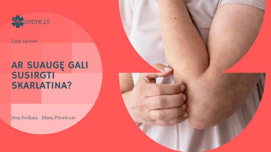 Ar suaugę gali susirgti skarlatina? Gydytojų paaiškinimas Ar suaugę gali susirgti skarlatina Gydytojų paaiškinimas