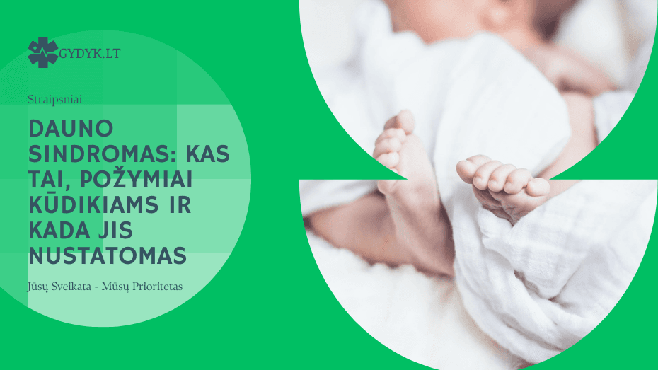 Dauno sindromas: kas tai, požymiai kūdikiams ir kada jis nustatomas Dauno sindromas kas tai, požymiai kūdikiams ir kada jis nustatomas