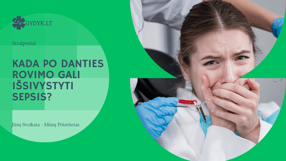 Kada po danties rovimo gali išsivystyti sepsis