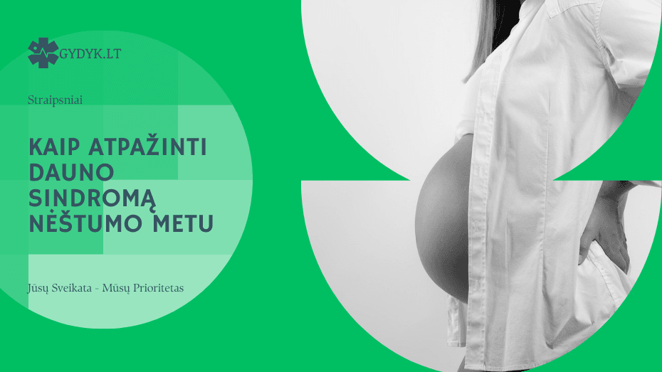 Kaip atpažinti Dauno sindromą nėštumo metu: požymiai, tyrimai ir rizikos veiksniai Kaip atpažinti Dauno sindromą nėštumo metu požymiai, tyrimai ir rizikos veiksniai