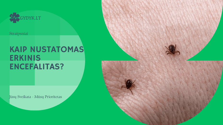 Kaip nustatomas erkinis encefalitas