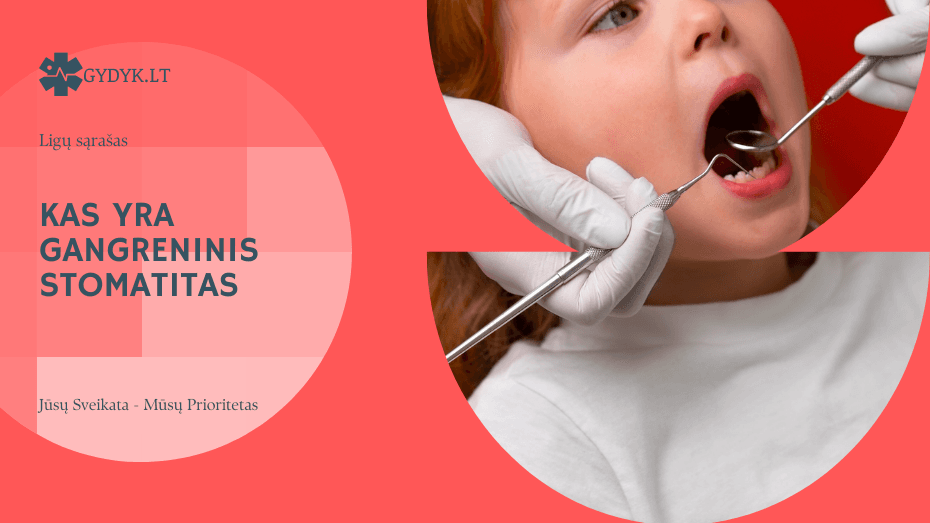 Kas yra gangreninis stomatitas ir kodėl jis toks pavojingas? Kas yra gangreninis stomatitas