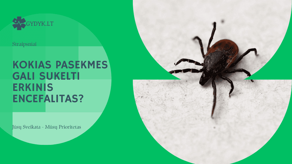 Kokias pasekmes gali sukelti erkinis encefalitas? Kokias pasekmes gali sukelti erkinis encefalitas