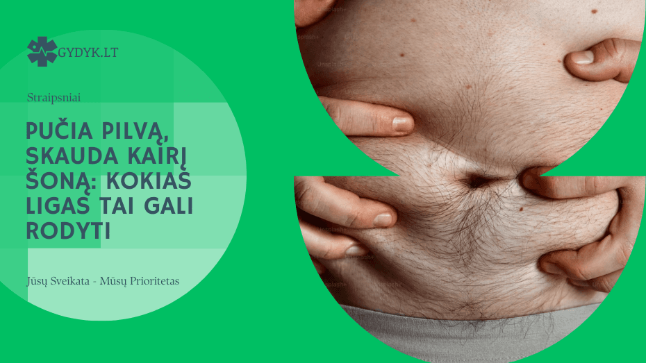 Pučia pilvą, skauda kairį šoną kokias ligas tai gali rodyti