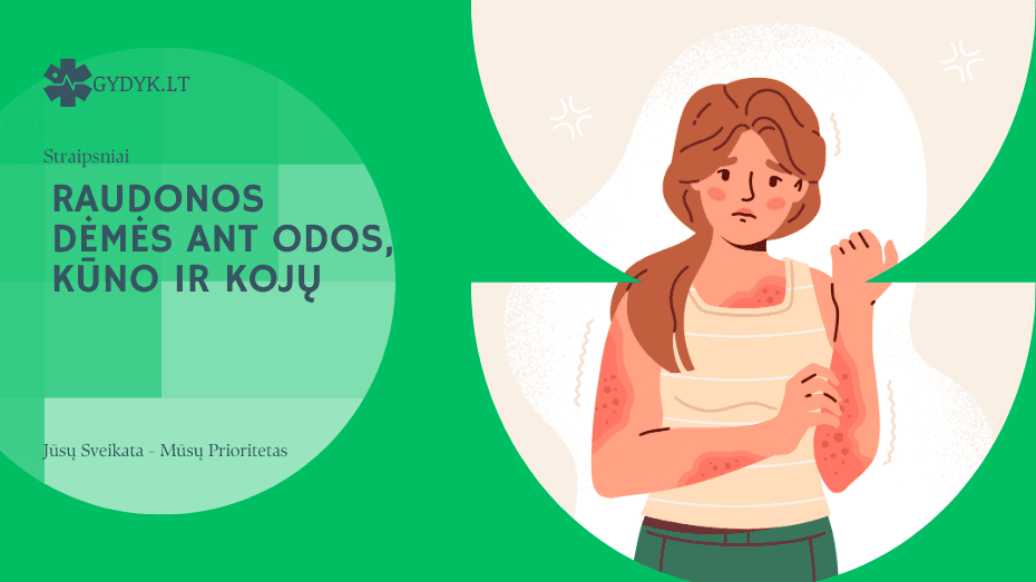 Raudonos dėmės ant odos, kūno ir kojų