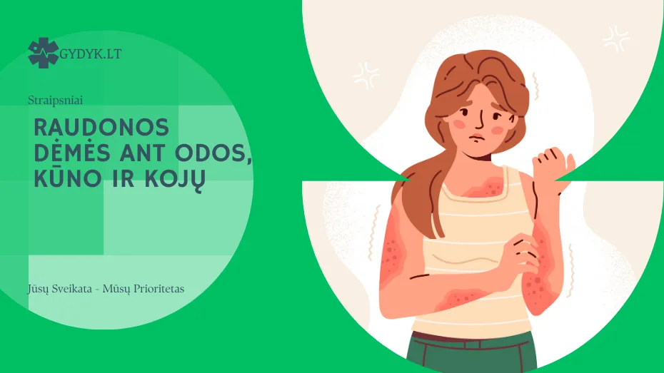 Raudonos dėmės ant odos, kūno ir kojų