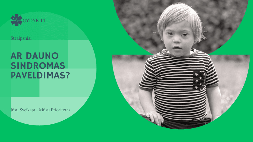 Ar Dauno sindromas paveldimas?