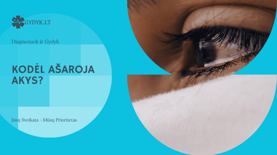 Kodėl ašaroja akys?