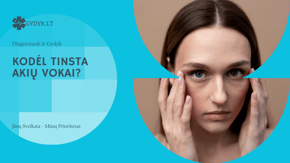 Kodėl tinsta akių vokai?
