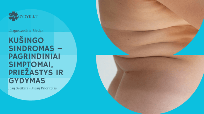 Kušingo sindromas – pagrindiniai simptomai, priežastys ir gydymas