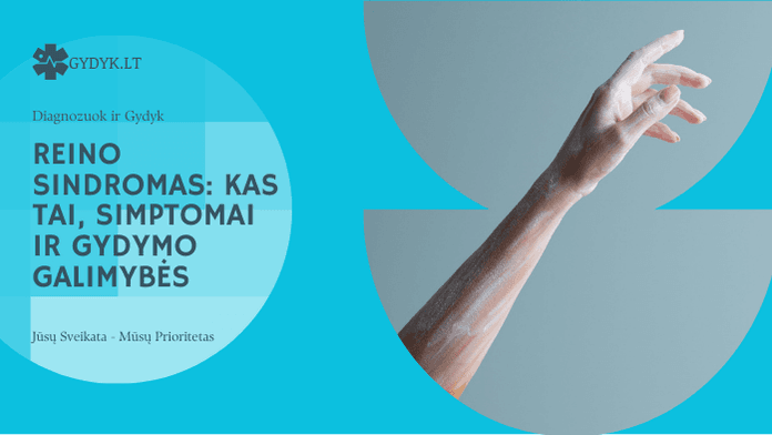 Reino sindromas: kas tai, simptomai ir gydymo galimybės