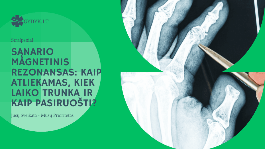 Sąnario magnetinis rezonansas: kaip atliekamas, kiek laiko trunka ir kaip pasiruošti?