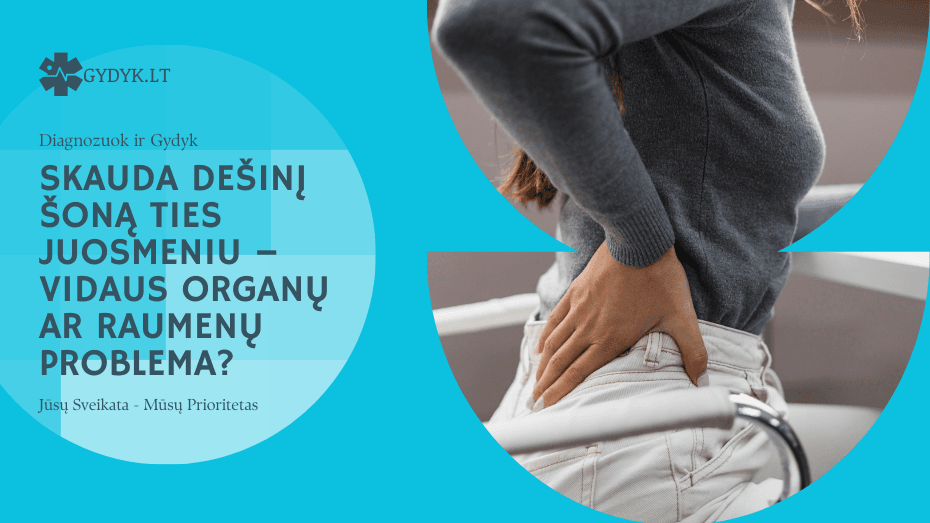Skauda dešinį šoną ties juosmeniu – vidaus organų ar raumenų problema?
