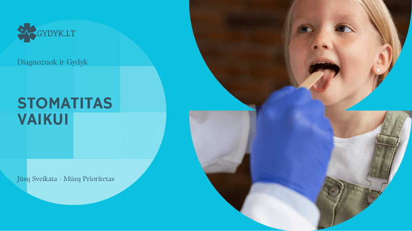 Stomatitas vaikui – pagrindinės priežastys, pirmieji simptomai ir veiksmingas gydymas